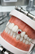 FORMATION BIJOUX DENTAIRE